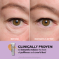 Buy 2 Get 1 Free💖5-Minute Eye Lift -Say goodbye to puffiness andfine lines ✨