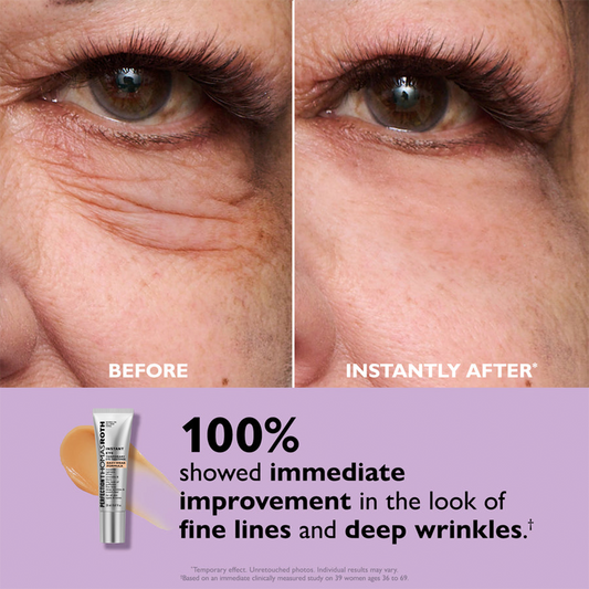 Buy 2 Get 1 Free💖5-Minute Eye Lift -Say goodbye to puffiness andfine lines ✨